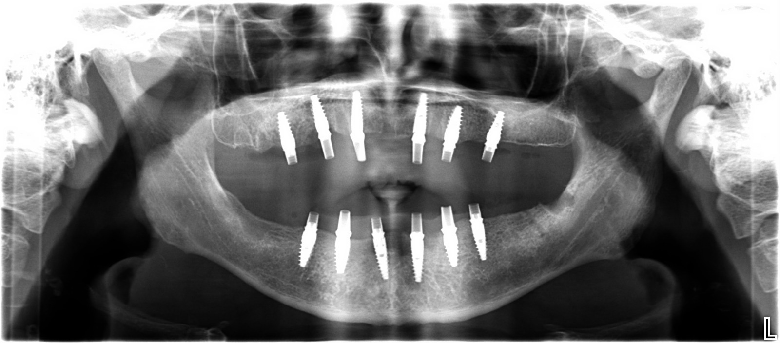 RESTORATIVE DENTISTRY