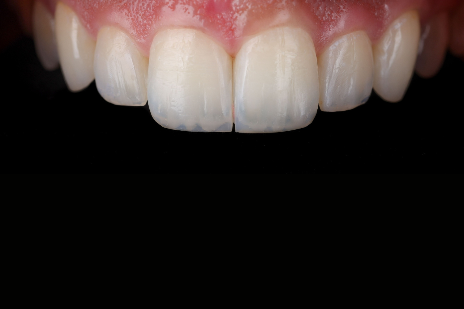 Cosmetic Dentistry