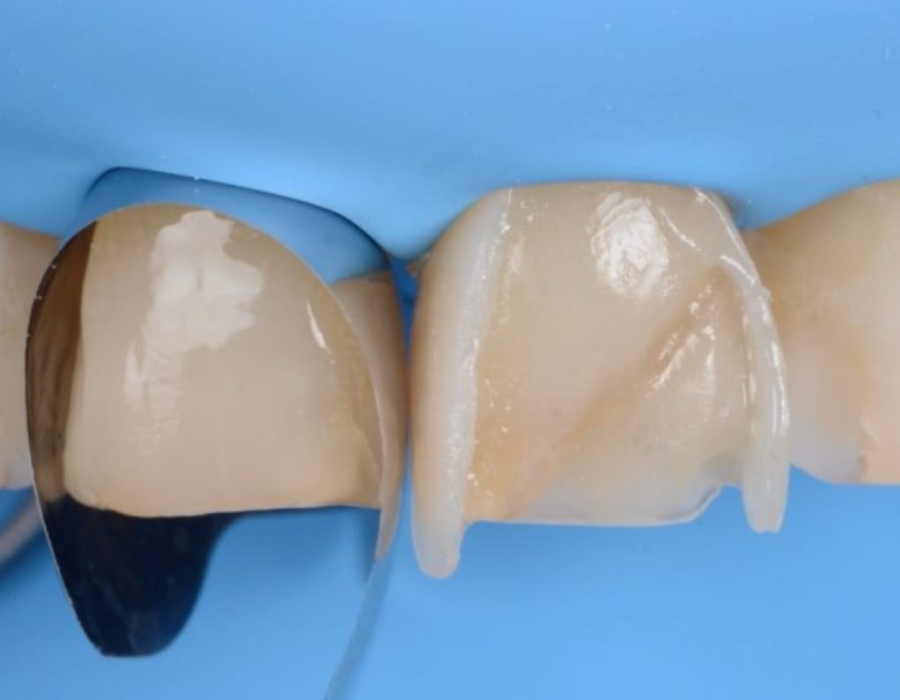 Restorative dentistry