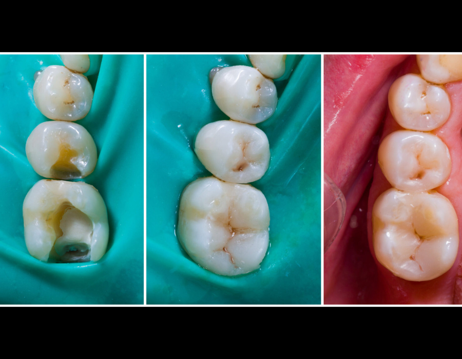 Endodontic Care