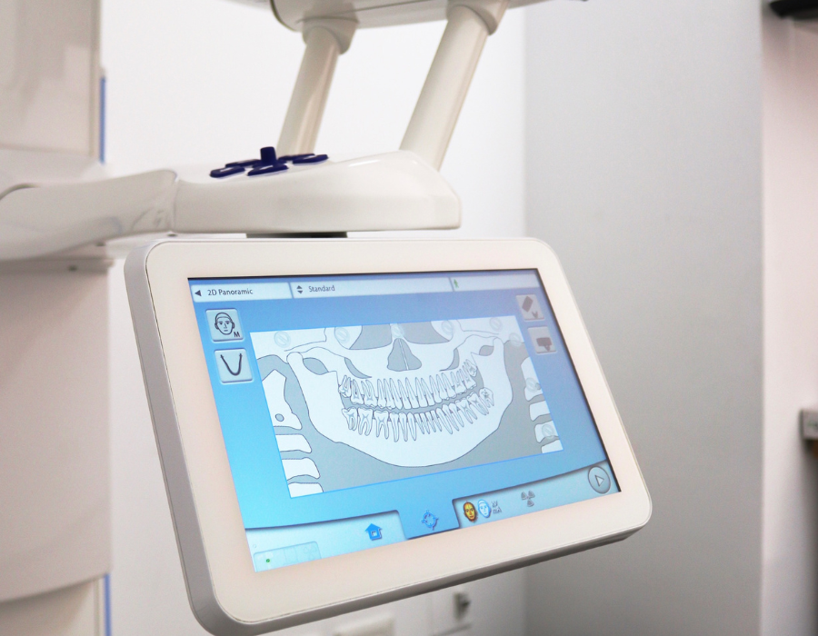 Advanced Dental Imaging with CBCT Technology