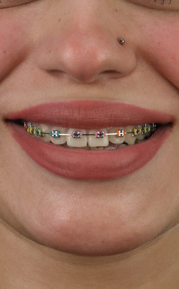 Orthodontics