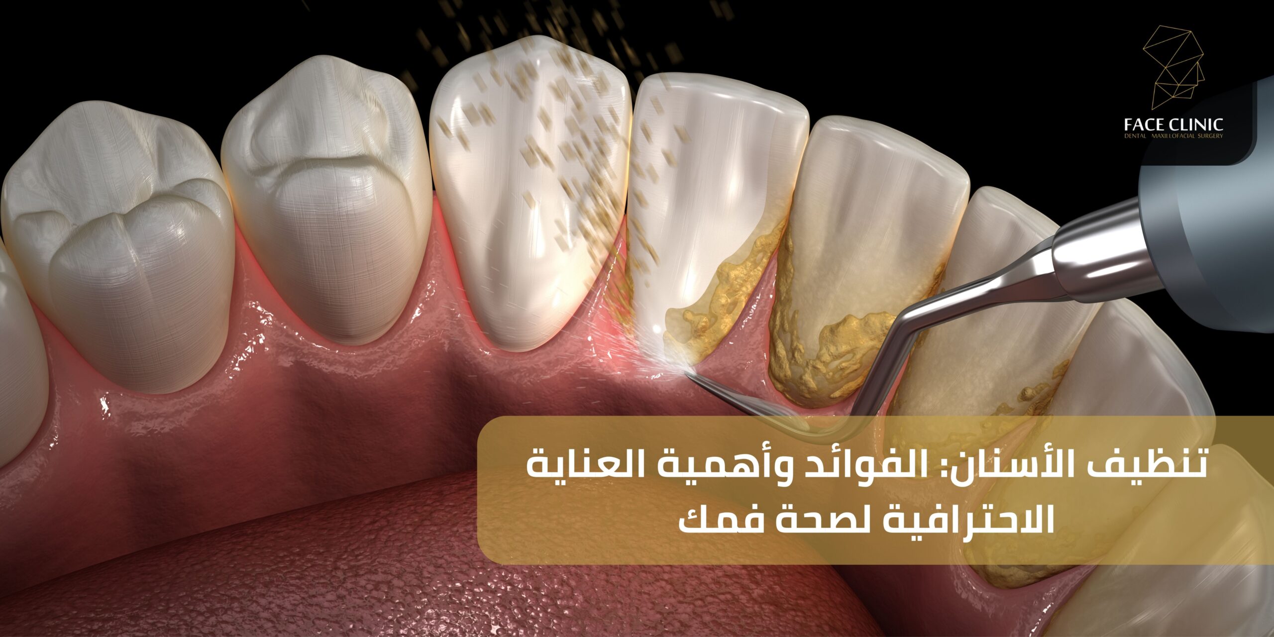 تنظيف الأسنان: الفوائد وأهمية العناية الاحترافية لصحة فمك تنظيف الأسنان