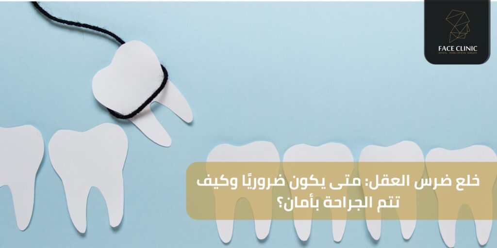 خلع ضرس العقل خلع ضرس العقل