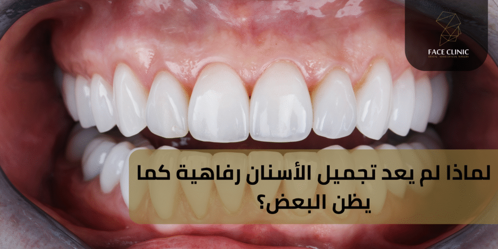 تجميل الأسنان