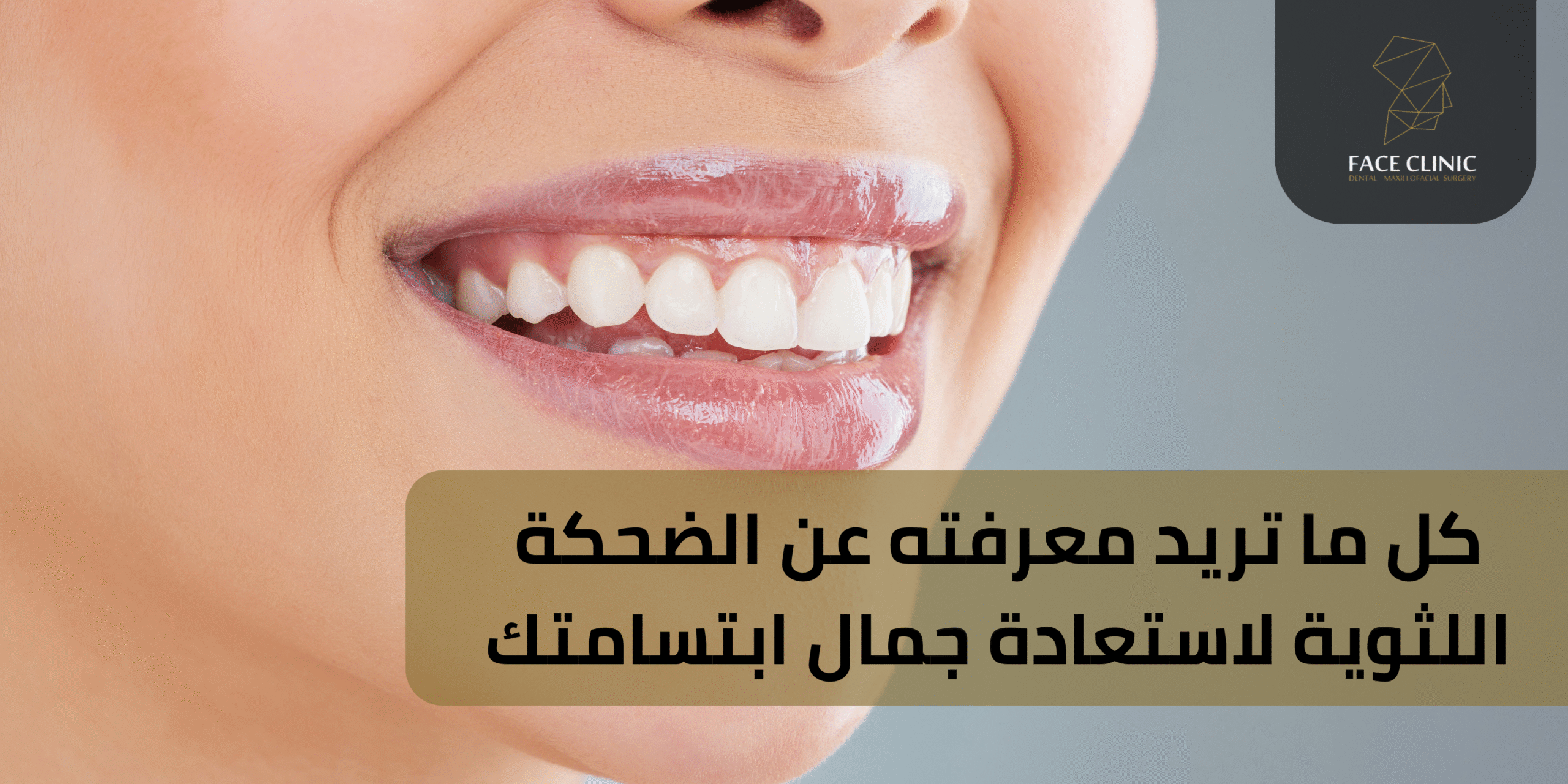 الضحكة اللثوية